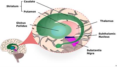 Neuro4PD: An Initial Neurorobotics Model of Parkinson's Disease